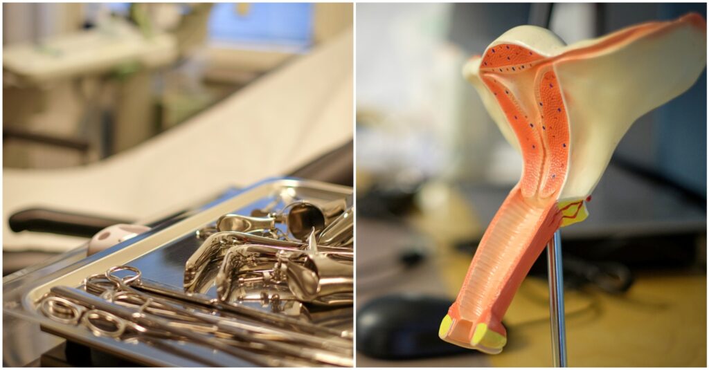 Bild på en gynstol med undersökningsinstrument i förgrunden och en modell av en vagina och livmoder.